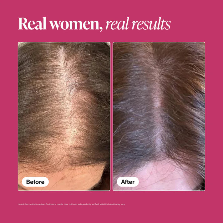 Viviscal Hair Growth Supplements For Women, 180 Tablets